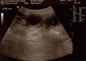 Ultraschallbild von ungeborenen Beaglewelpen in Hannover